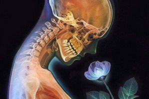 Рентген рисунок