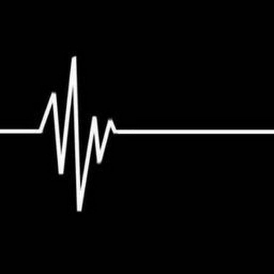 Кардиограмма остановки сердца