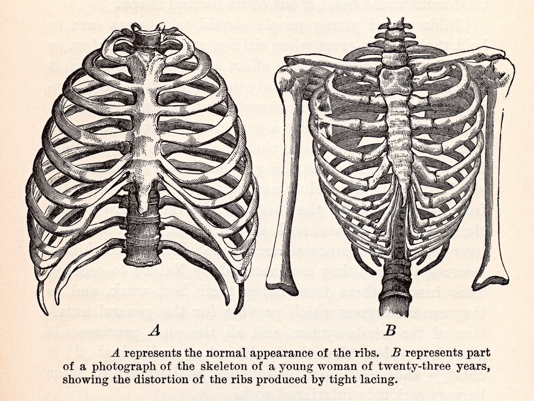 Показать ребра человека. Грудная клетка с ребрами и грудиной. Скелет грудной клетки Грудина. Анатомия скелет грудной клетки ребра Грудина. Ребра анатомия Синельников.