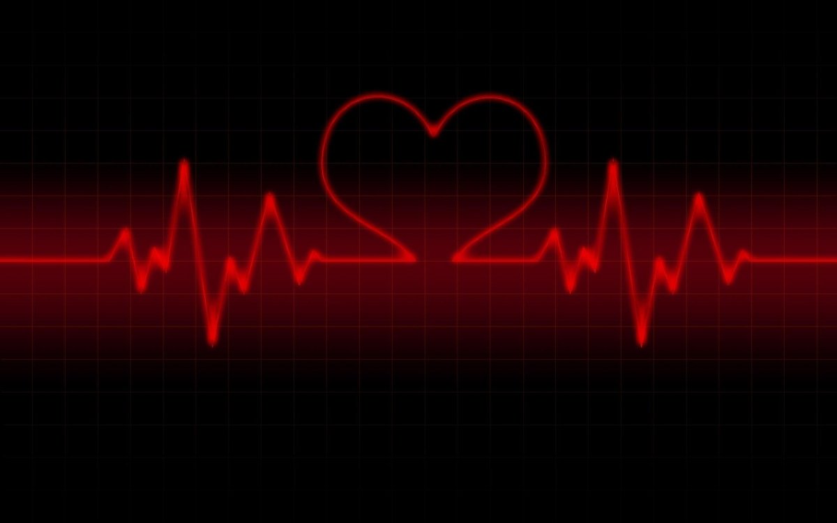 Нарисовать пульс