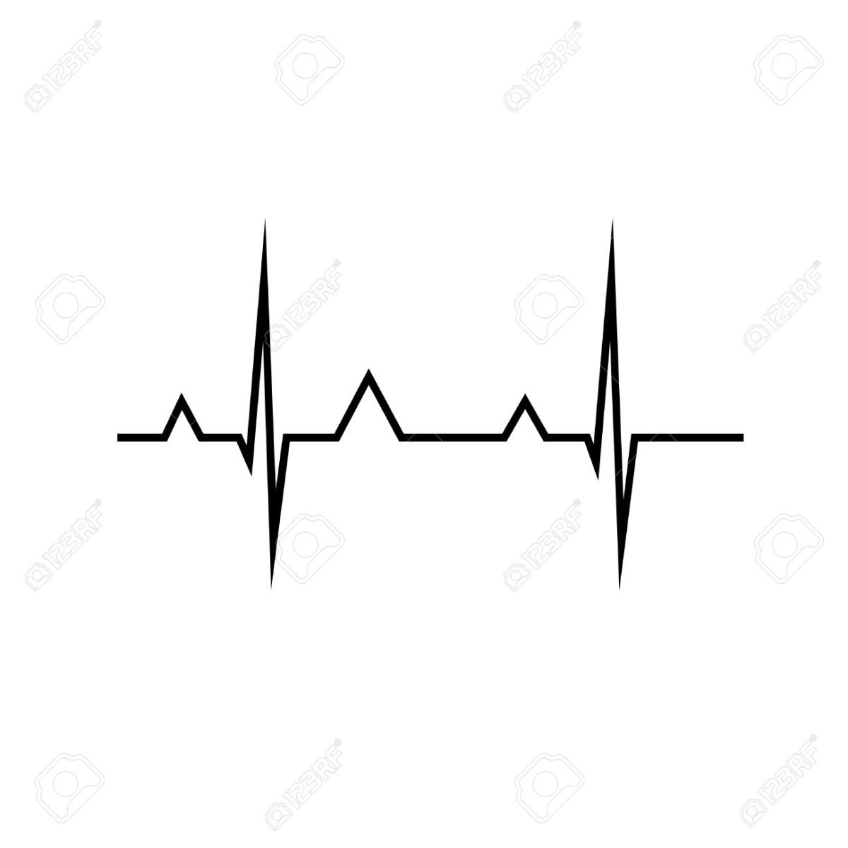 ЭКГ на белом фоне